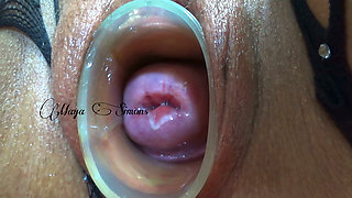 This Is What My Cervix Looks Like After a Year Without Seeing It