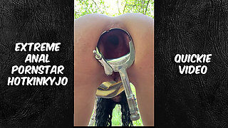 03.august.2026 Video Quickie Prolapse