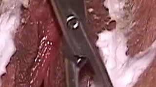 Mature Women Watch Doctor Spread Thick Creampie