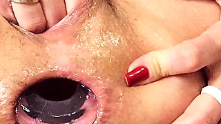 Arch. 1. Trying Anal Fisting