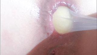 Assholegap Gaping Analstretch Analplay