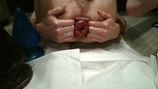 Grip 126, Prolapse, Fisting