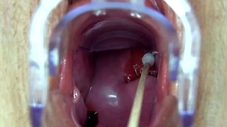 Melinda video
