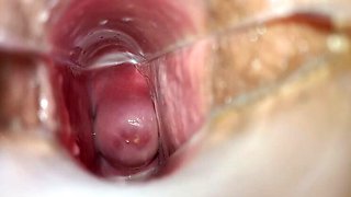 Speculum Inside Vagina: Real Orgasm