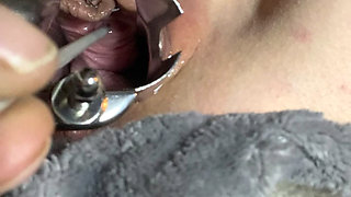 Lara insertion belle fille