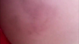 My Butt Cheek Got Purple From a Spanking