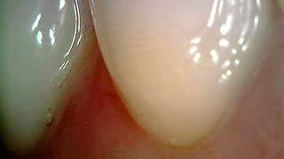 Medical Endoscope Oral Exam: Gummy Chewing, Extreme Teeth & Tongue Macro