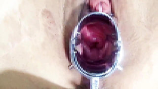 Using a Speculum to Spread an M-woman's Pussy, Anal Training　1/2